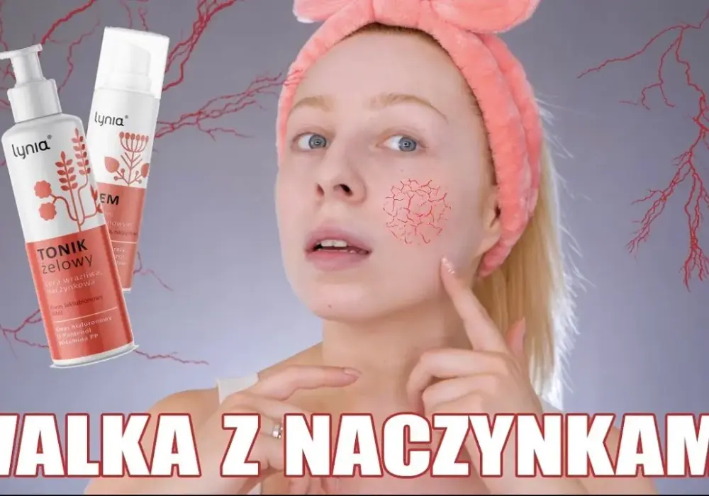 Jaki kwas do cery naczynkowej? Najlepsze opcje dla wrażliwej skóry