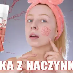 Jaki kwas do cery naczynkowej? Najlepsze opcje dla wrażliwej skóry