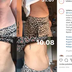 Szczotkowanie brzucha - jakie efekty przynosi dla zdrowia i urody?